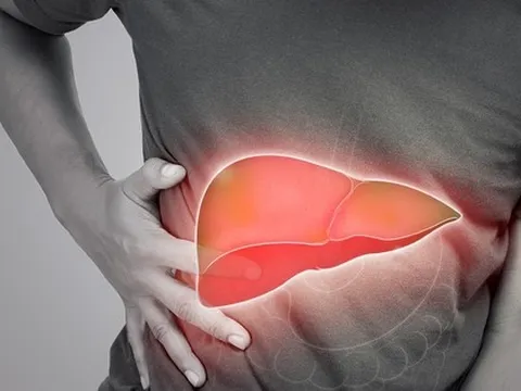 Mắc bệnh gan nhiễm mỡ vì thứ tưởng rằng "lành mạnh"