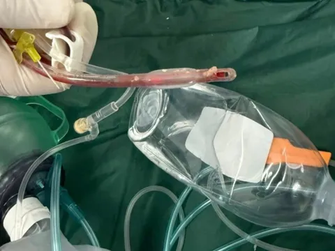 Bé gái 3 tuổi tử vong thương tâm sau khi sặc thức ăn ở nhà trẻ 1