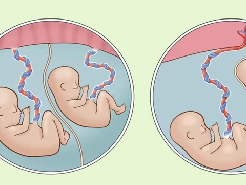Bé trai nặng chưa đầy 1 kg được cứu sống thần kỳ