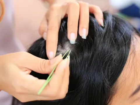 Hóa ra đây là lý do bạn không nên nhổ tóc bạc
