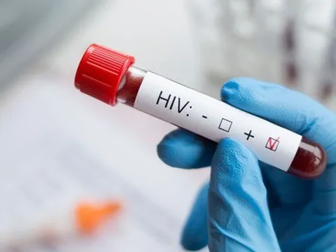 Đi khám sức khỏe định kỳ, nam shipper 35 tuổi phát hiện nhiễm HIV: Choáng váng khi biết nguồn lây