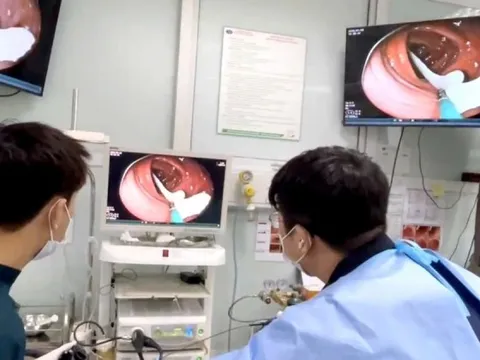 Sán dây dài gần 1 mét sống trong đại tràng người đàn ông có thói quen ăn đồ tái